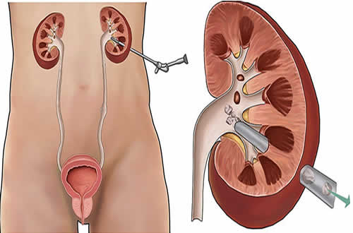Best Urology Doctor in swabi, Aljannat Hospital Urology Department