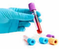 Best Laboratory in Swabi, Aljannat hospital laboratory